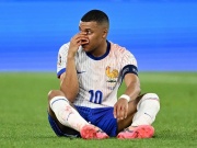 Bóng đá - Mbappe lên tiếng vụ bị gãy mũi đáng sợ ở EURO, fan khuyên đeo mặt nạ