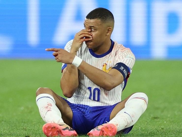 Tin mới vụ Mbappe gãy mũi: Siêu sao phải phẫu thuật, đăng thông điệp ẩn ý