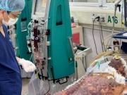 Sức khỏe đời sống - Người đàn ông 57 tuổi sốc nhiễm khuẩn, suy đa tạng vì loại vi khuẩn dễ gặp khi chế biến thực phẩm này