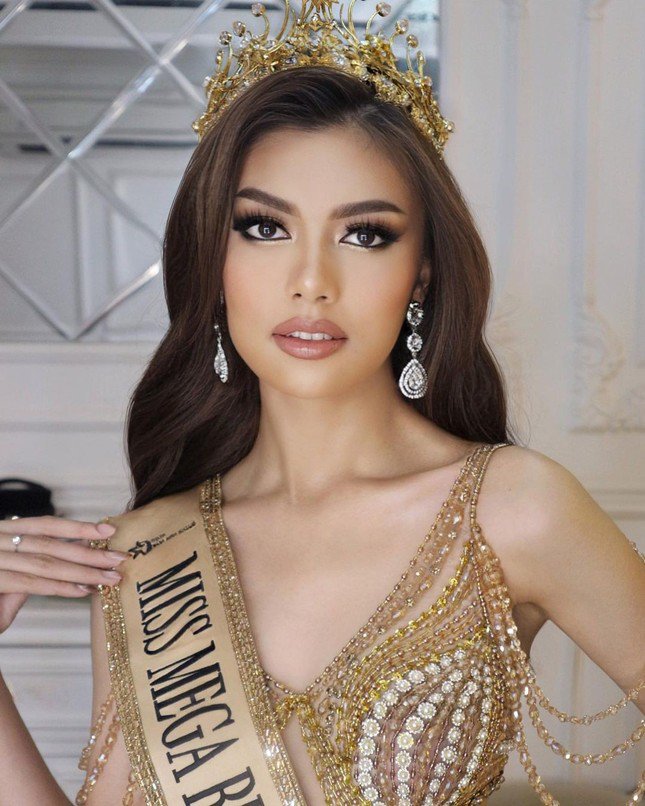 Ngoại hình Hoa hậu Hòa bình Indonesia 2024 sau thẩm mỹ - 3