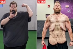 Thể thao - Người đàn ông nặng 265 kg giảm cân kỳ diệu, giờ còn 1 tạ