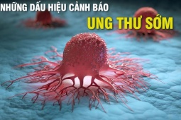 Sức khỏe đời sống - Những dấu hiệu cảnh báo ung thư sớm