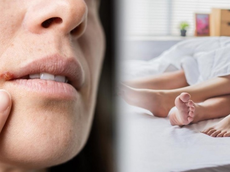 Kiểu “yêu“ có thể khiến virus herpes xâm nhập não, gây sa sút trí tuệ