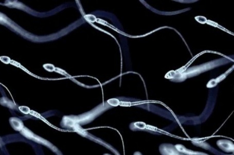 Thanh niên 20 tuổi được ghép tế bào gốc để tạo... tinh trùng