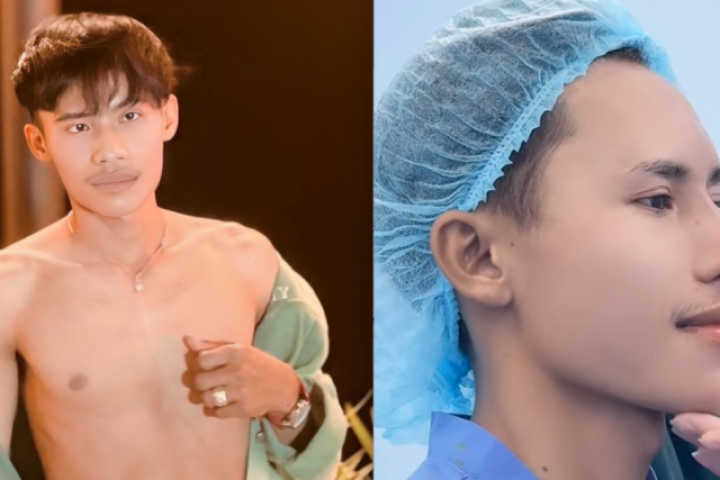 Diện mạo thí sinh Nam vương Campuchia sau khi 'dao kéo' tại Việt Nam