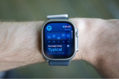 Apple Watch bất ngờ giúp phát hiện ung thư máu và cứu sống người dùng