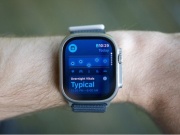 Apple Watch bất ngờ giúp phát hiện ung thư máu và cứu sống người dùng