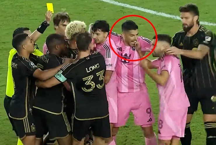 Messi bị đau, Suarez lại "nổi điên suýt cắn nhầm" đồng đội