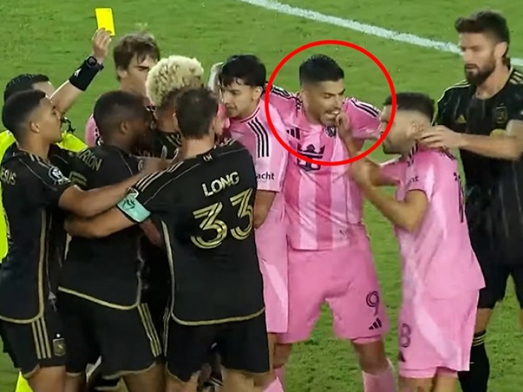 Messi bị đau, Suarez lại “nổi điên suýt cắn nhầm“ đồng đội