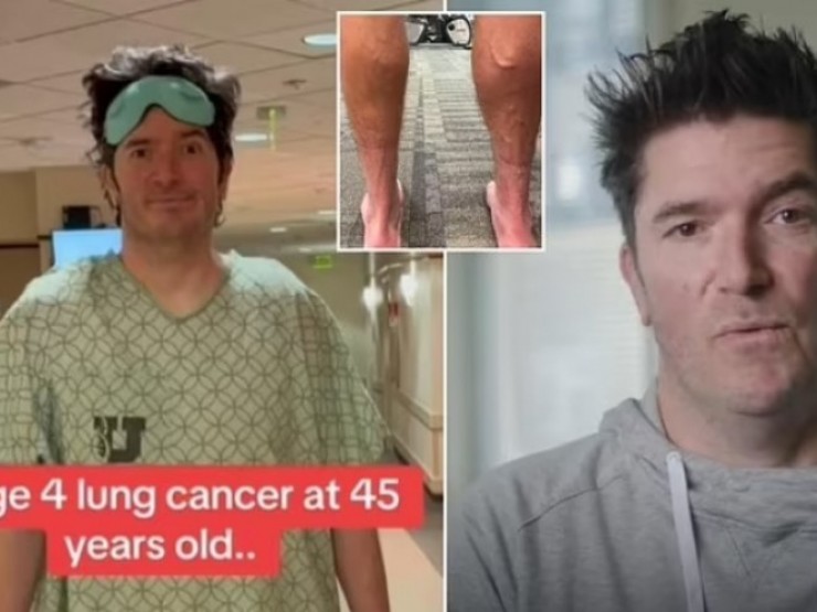 Giám đốc chưa từng hút thuốc, cực kỳ khỏe mạnh vẫn bị ung thư phổi giai đoạn cuối