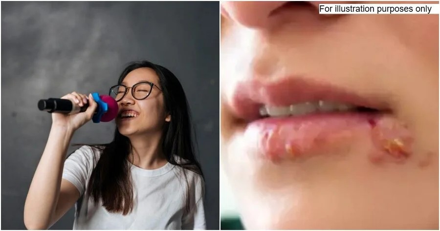 Nhiễm virus chỉ vì hát quá gần micro.