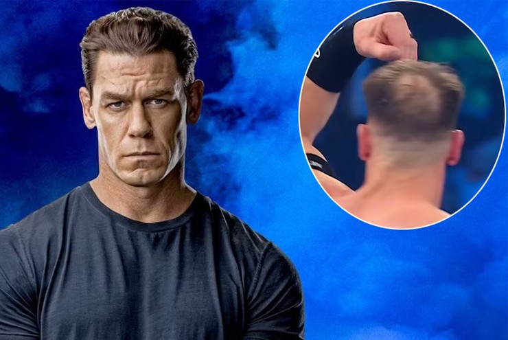 Tài tử 'Fast and Furious' đi cấy tóc sau khi bị chế giễu đầu hói