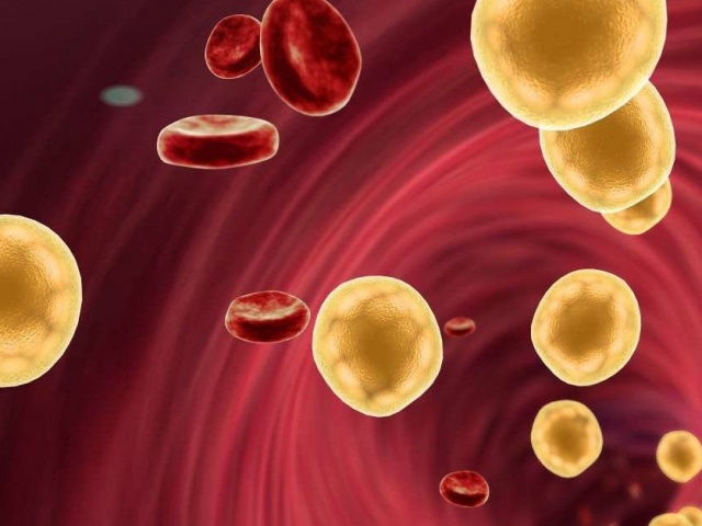 Tại sao ‘gầy như que củi’ mà vẫn bị mỡ máu cao?