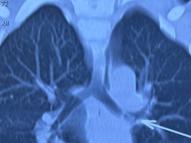 Cha mẹ tá hỏa nghe tiếng kèn phát ra theo nhịp thở của con