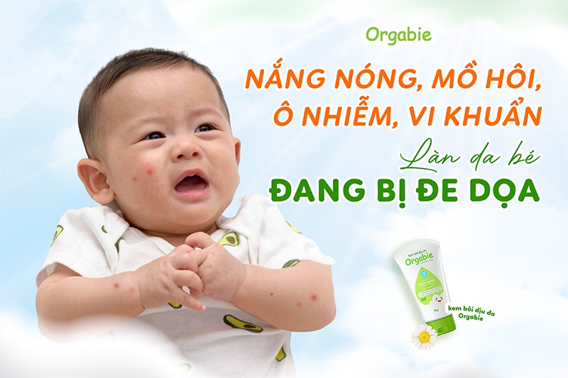 Trẻ nhỏ dễ mắc bệnh ngoài da mùa hè – làm sao bảo vệ con yêu? - 1