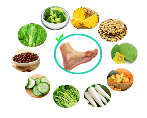 Chế độ dinh dưỡng cho người bệnh gout quan trọng nhất là hạn chế tối đa dung nạp các thực phẩm có hàm lượng purin cao và frustose cao.