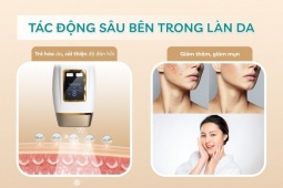 Crenot Graci X3 – Giải pháp triệt lông vĩnh viễn tại nhà an toàn, tiết kiệm cho phụ nữ hiện đại
