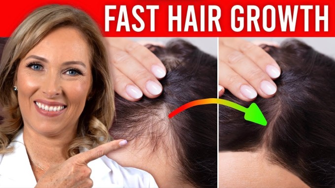 Bác sĩ cho rằng gội đầu một lần mỗi tuần không đủ để làm sạch da đầu và có thể làm tích tụ hợp chất dihydrotestosterone, cản trở sự phát triển của tóc.