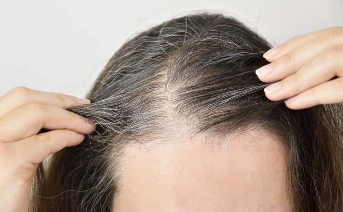 Thiếu sắt có thể làm giảm lượng hồng cầu trong cơ thể, ảnh hưởng đến sự phát triển của nang tóc, làm tăng nguy cơ tóc bạc sớm và rụng tóc.