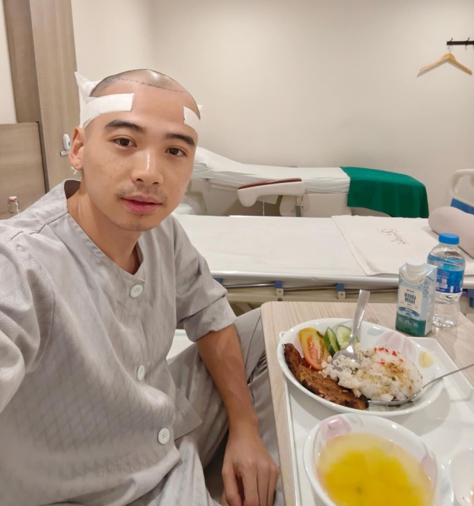 Tuấn Khôi tẩm bổ trước khi cấy tóc.