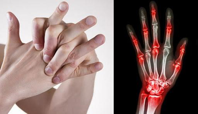 6 thói quen “rút ngắn tuổi thọ” xương khớp - Nhiều người vẫn mắc - 1