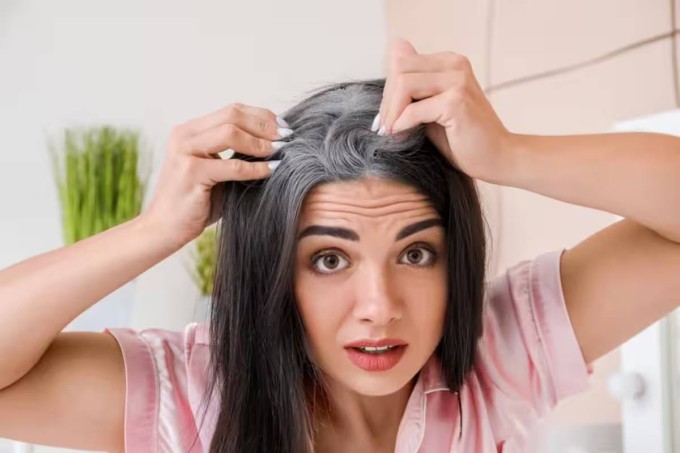Ba cách phục hồi tóc bạc không cần nhuộm - 1