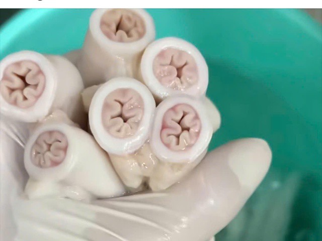 Lòng se điếu trên MXH