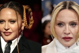 Madonna được khen khuôn mặt không còn đơ cứng tại Met Gala