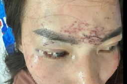 Khởi tố vụ bắt người phụ nữ đem về xăm, cắt tóc và đánh đập gây chấn động dư luận ở Cà Mau