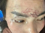 An ninh - Xã hội - Khởi tố vụ bắt người phụ nữ đem về xăm, cắt tóc và đánh đập gây chấn động dư luận ở Cà Mau