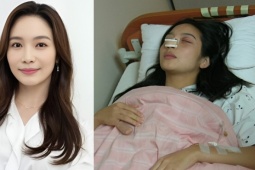 Cuộc sống mỹ nhân ' Anh em nhà bác sĩ ' sau 19 năm bị chồng đánh sảy thai, gãy mũi