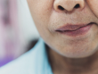 Mưa gió, nhiều người ngủ dậy bỗng méo miệng