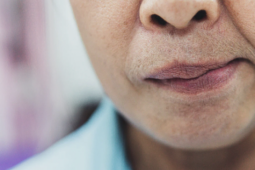 Mưa gió, nhiều người ngủ dậy bỗng méo miệng