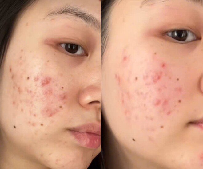 Món ăn được đồn giúp da sáng mịn có gì khiến chị em tranh cãi, người khen ngon, người chê "không nuốt nổi" - 4