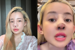  " Nghiện "  phẫu thuật thẩm mỹ, Ngân 98 lại chuẩn bị  " đập đi xây lại " 