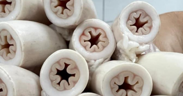 Lý giải bất ngờ về lòng se điếu, ảnh hưởng sức khỏe khi ăn nhiều