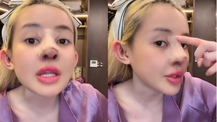 Nhiều netizen còn cho rằng bạn gái Lương Bằng Quang đã "nghiện" chuyện dao kéo.