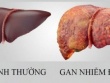 Loại quả mùa hè rẻ tiền, ngọt mát giúp làm mát gan, người Việt dùng vào thời điểm này để giúp gan thải độc
