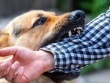 Bé trai 13 tuổi nguy kịch sau 2 tháng bị chó cắn vì việc làm này của người thân