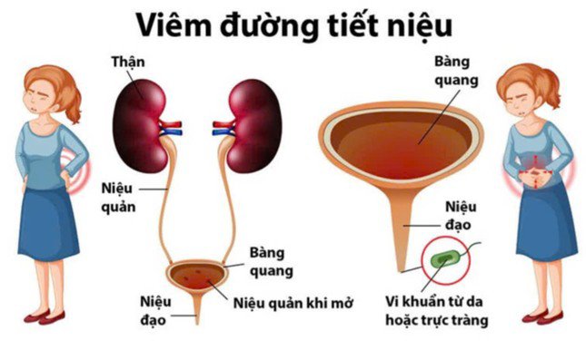 Những dấu hiệu cảnh báo của cơ thể dễ bị chị em bỏ qua nhưng &#39;phá thận&#39; nhanh khủng khiếp - 2