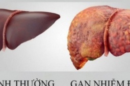 Loại quả mùa hè rẻ tiền, ngọt mát giúp làm mát gan, người Việt dùng vào thời điểm này để giúp gan thải độc