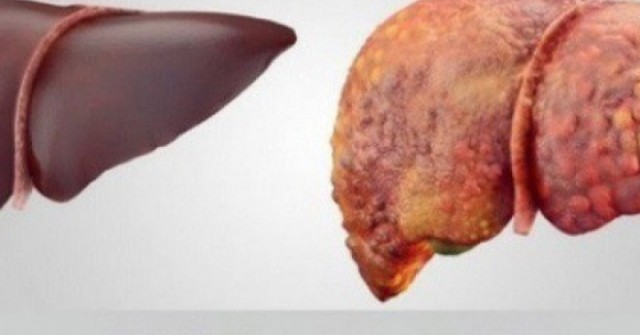 Loại quả mùa hè rẻ tiền, ngọt mát giúp làm mát gan, người Việt dùng vào thời điểm này để giúp gan thải độc