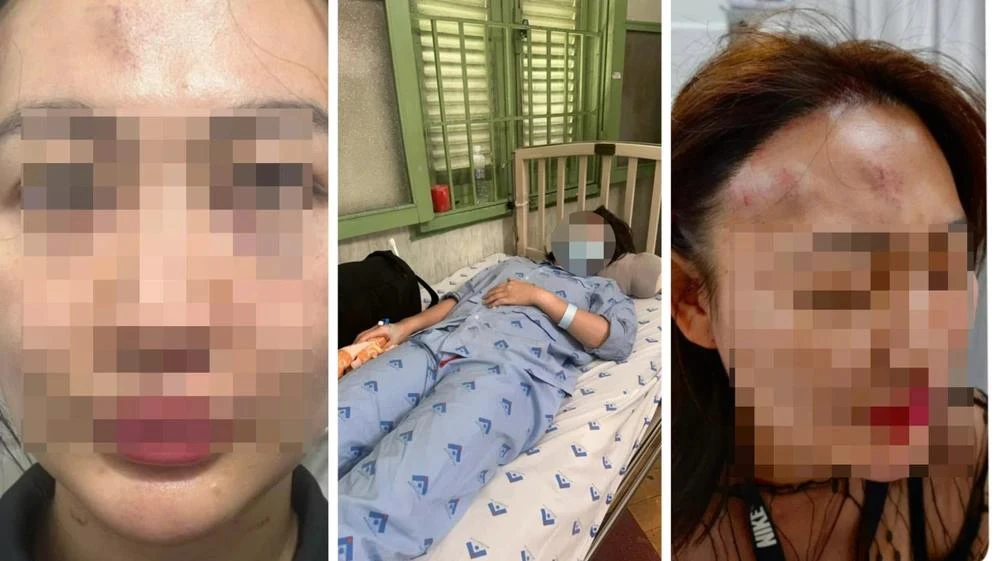 Hình ảnh thương tích của cô gái sau khi bị đánh. Ảnh: HT