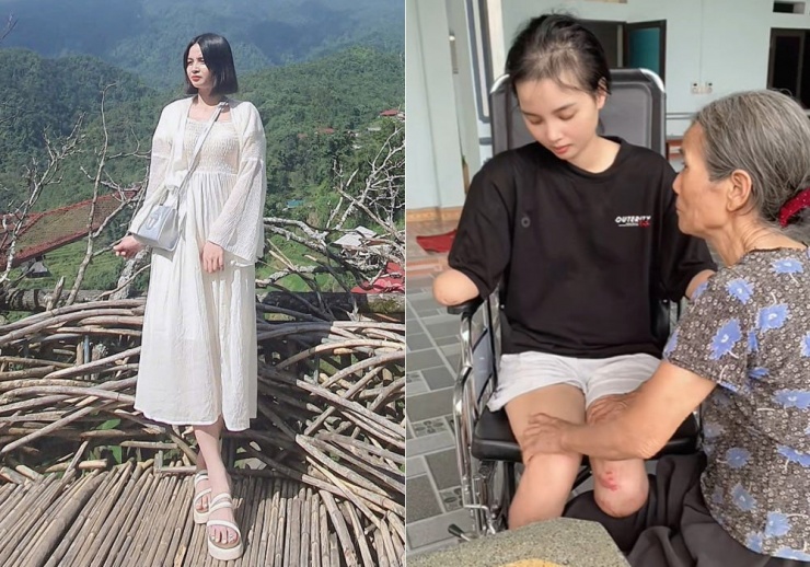 Nga phải cắt bỏ tứ chi vì cơn bạo bệnh&nbsp;