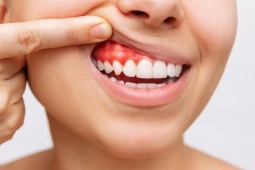 Sức khỏe răng miệng – Nền tảng của cơ thể khỏe mạnh