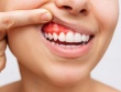Sức khỏe răng miệng – Nền tảng của cơ thể khỏe mạnh
