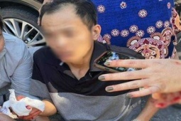 Chủ tịch Công ty Pha Lê Quảng Nam thuê giang hồ chém cổ đông dã man