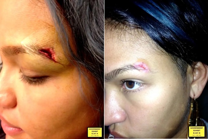 Hai bức ảnh chụp cận cảnh đuôi mày của Cassie Ventura bị rách năm 2013. Cô kể đây là vết tích trong một lần bị Diddy hành hung quăng lên giường khiến cô đập mặt vào góc giường. Cassie làm chứng rằng Diddy đã nổi cơn thịnh nộ vì cô ngủ quên và chưa đóng vali hành lý cho chuyến đi của họ.