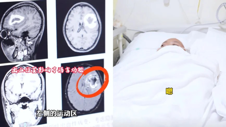 Hình ảnh chụp X-quang não của bệnh nhân.