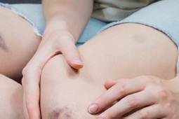 Dấu hiệu cảnh báo bạn có thể bị chảy máu não, đừng bỏ qua kẻo  ' ân hận đã muộn ' 